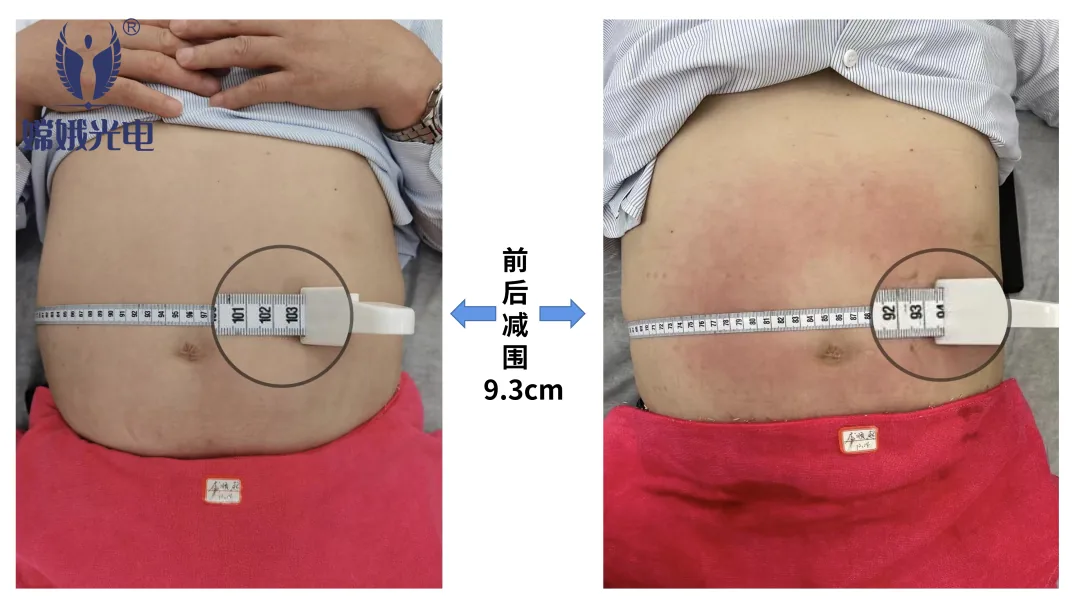 减肥黑科技——嫦娥爆脂机器人要你好看!(图22) 296eee061a6574ed5644bb4a37c16710.png
